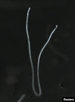 Filaments of the bacterium Thiomargarita magnifica from Guadeloupe, a French archipelago in the Caribbean, are seen in this undated handout image. (Jean-Marie Volland/U.S. Department of Energy's Lawrence Berkeley National Laboratory/Handout via REUTERS)