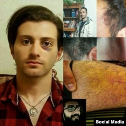 Sərbəst buraxılan türk fəallar işgəncəyə məruz qaldıqlarını bildirirlər