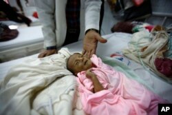 A doctor touches a malnourished child in Yemen.