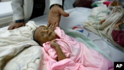 FILE - A doctor touches a malnourished child at a therapeutic feeding center in a hospital in Sanaa, Yemen, Jan. 24, 2016.