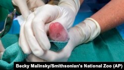 One of the giant panda cubs is examined by veterinarians after being born at Smithsonian's National Zoo in Washington, Aug. 22, 2015.