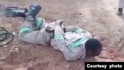 One of the workers allegedly brutalized by Chinese employers in Zimbabwe