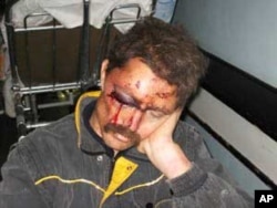 Zimbabwean farmer, Ben Freeth, waits for medical treatment in hospital after an attack on his farm by Zanu-PF supporters