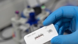 科学家：不能对抗体测试期望值过高