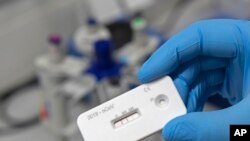 A scientist presents an antibody test for coronavirus in a laboratory of the Leibniz Institute of Photonic Technology (Leibniz IPHT) at the InfectoGnostics research campus in Jena, Germany, Friday, April 3, 2020. 