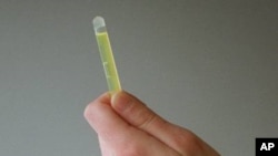 Tim peneliti Amerika dan Brazil mengembangkan kombinasi tes papsmear yang juga dapat mendeteksi dua jenis tumor ginekologi yang sulit dikenali dan berpotensi mematikan (foto: Dok).