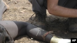 A guinea worm emerges from the leg of a south Sudanese girl in Juba. (File Photo)