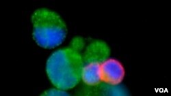 Tahun lalu Johnson&Johnson mengumumkan akan merilis alat pendeteksi kanker darah atau HB-Chips ke pasaran. Alat ini mampu mendeteksi sel kanker darah di antara sel-sel yang sehat. (foto: dok)