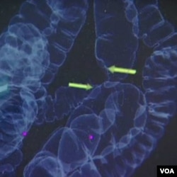 Kanker usus besar dapat dideteksi dari tumbuhnya 'polip'.