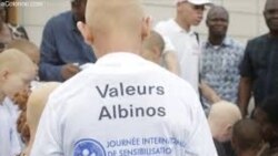 La Guinée se dote d'une loi pour la défense des personnes atteintes d'albinisme