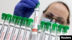 Uprkos znacima da omikron izaziva blaže simptome u proseku, stopa infekcija u SAD je bez presedana.