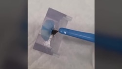 Des abeilles et des chiens pour détecter les cancers