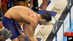 Tanda-tanda bulatan bekas bekam di tubuh perenang Michael Phelps membuat banyak orang bertanya-tanya (7/8).