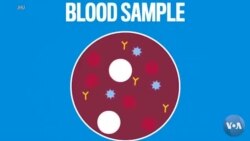 COVID-19: Vaksina yo'q, umid antitanachalardan