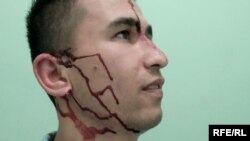 Abdullo Ghurbati posted pictures on social media after suffering what he said was an attack by two unknown assailants in Dushanbe. (Source: RFE/RL)