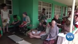 Women Living With Albinism Struggle to Find a Good Job