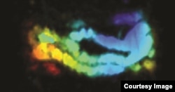 The combination of nanojuice and photoacoustic tomography illuminates the intestine of a mouse. (Credit: Jonathan Lovell)