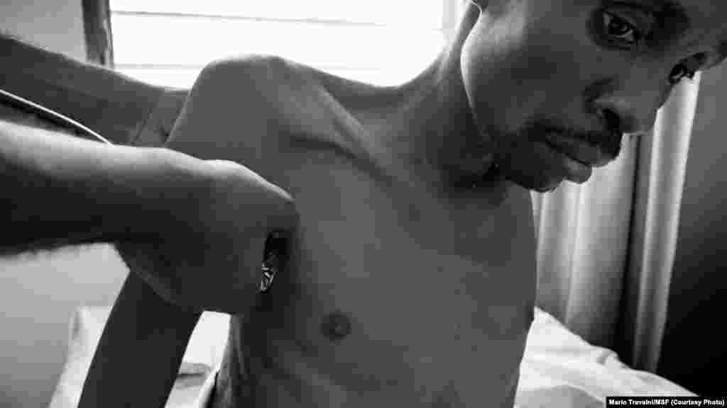 André, 42 ans, est dans un état grave au Centre Hospitalier de Kabinda, Kinshasa, RDC, 24 janvier 2012. (MSF/Mario Travaini)