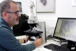 In this Thursday, Nov. 8, 2018 photo, Pantelis Katharios, senior researcher at the Hellenic Center for Marine Research on the Greek island of Crete, checks microscope imaging of a new parasite.
