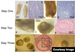 Close-up of human eggs during development stages. (Photo courtesy of Professor Evelyn Telfer and Dr. Marie McLaughlin)