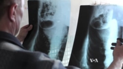 Amnesty International: 'Overwhelming Evidence' of War Crimes in Ukraine