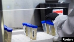 Laboratorijski uzorci tokom ispitivanja kovida, ilustracija