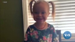 California Talent Agency Represents Disabled Actors