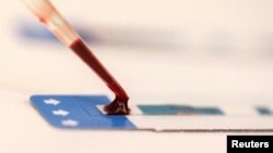 FILE - Nurse tests blood sample during free HIV testing clinic in Bangkok, Thailand.