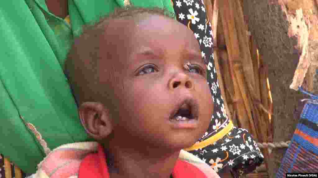 Mamadou a un an et ne pèse même pas 6 kilos. Il vit dans le camp de réfugiés d’Assaga, Diffa, Niger, le 18 avril 2017 (VOA/Nicolas Pinault)