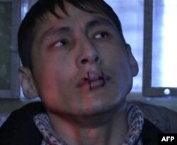 Bishkekdagi hibsxonada 391 mahbus og'zini tikib olgan. Faqat suv icha oladi. Qiynoq va azobga nisbatan javob bu, deydi ular. Mamlakat bo'ylab qariyb 1000 mahbus mana shunday norozilik namoyishi qilmoqda.