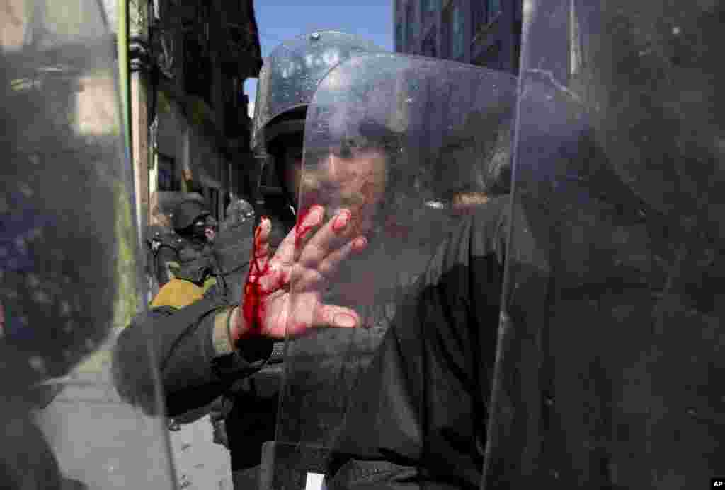 A police officer&#39;s hand is bloodied as he blocks protesters with disabilities from reaching Plaza Murillo in La Paz, Bolivia, May 25, 2016. Protesters marched to the National Palace to demand an increase in government disability compensation.