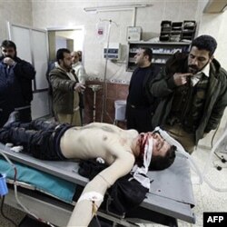 O'tgan bir necha kun ichida Suriyada hukumat kuchlari 300 ga yaqin odamni o'ldirgan