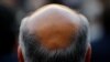 A new study has found that males of short stature are at increased risk of losing their hair prematurely, in addition to a number of other health conditions.