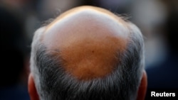 A new study has found that males of short stature are at increased risk of losing their hair prematurely, in addition to a number of other health conditions.