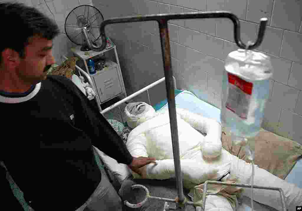 Pravin Joshi, 30, who tried to self-immolate in protest against the Hindi film "Fanaa," receives treatment at a hospital in Jamnagar, in the western Indian state of Gujarat. Joshi set himself on fire on in the bathroom of a movie theater screening the fil