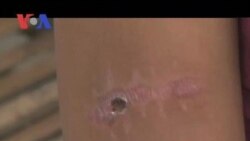 Shooting Victims in Fear as Alleged Shooter Goes Free (Cambodia news in Khmer)