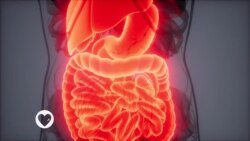 Fahamu saratani ya utumbo ilivyo hatarishi kwa bindamu