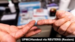 Fingertip-sized patches with dissolvable microscopic needles, a potential COVID-19 vaccine, are seen at the University of Pittsburgh, Pittsburgh, Pennsylvania