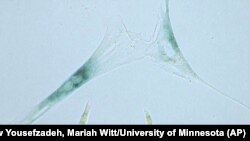 This April 2019 microscope photo provided by the Niedernhofer Lab of the Institute on the Biology of Aging and Metabolism at the University of Minnesota shows shows two senescent human fibroblast cells, above, next to normal ones in Minneapolis.