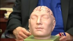 3D模型可帮助医生做好高难度手术