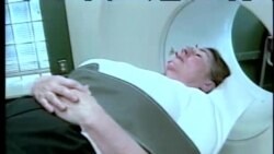 Alsgeymer qanday kasallik? Hope for Alzheimers