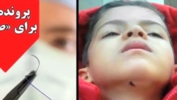 حکم زندان برای پزشک و پرستاری که بخیه کودک را باز کردند