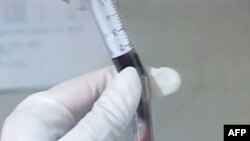 შიდსის აღმოჩენიდან 30 წელი გავიდა