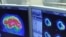 Brain scan