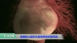 健康的心脏和大脑将降低失智风险