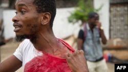 A man shows his injuries on September 20, 2016, near the offices of the main opposition party, Union for Democracy and Social Progress in the Democratic Republic of Congo.