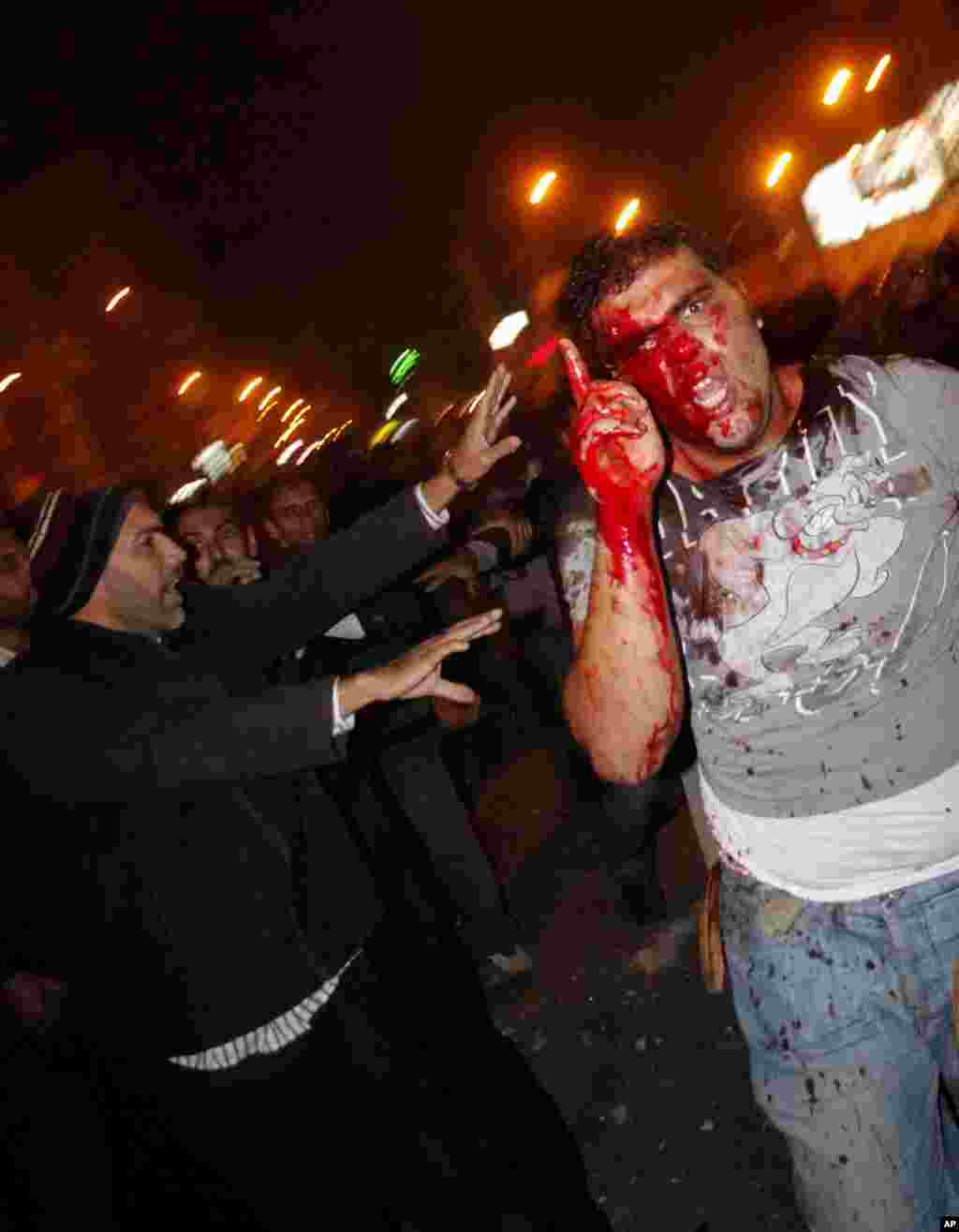 A wounded protester reacts during clashes between supporters and opponents of Egyptian President Mohamed Morsi outside the presidential palace in Cairo, December 5, 2012. 