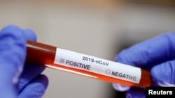 Tabung reaksi dengan label nama virus corona terlihat dalam gambar ilustrasi yang diambil pada 29 Januari 2020. (Foto: Reuters/Dado Ruvic)