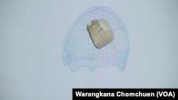 A sample of a CT scan of a human skull at EpiBone, a NY-based bone-growing startup.