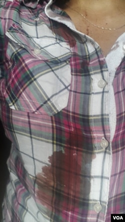 VOA Kurdish's Hatice Kamer (R) reported being attacked in Midyat, Turkey, June 8, 2016.